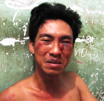 Giải cứu bé gái 8 tuổi bị kề dao khống chế làm con tin