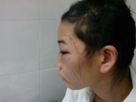 Chồng bắt vợ tự cắt tóc, rạch mặt vì... tin nhắn lạ