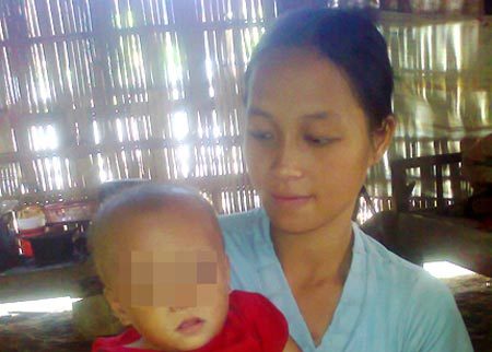 Hà Giang: Bé gái sở hữu hai... 'của quý'
