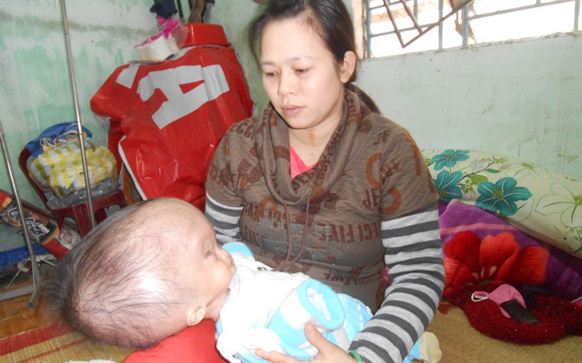 Khóc nghẹn cảnh bé sơ sinh mắc bệnh não úng thủy
