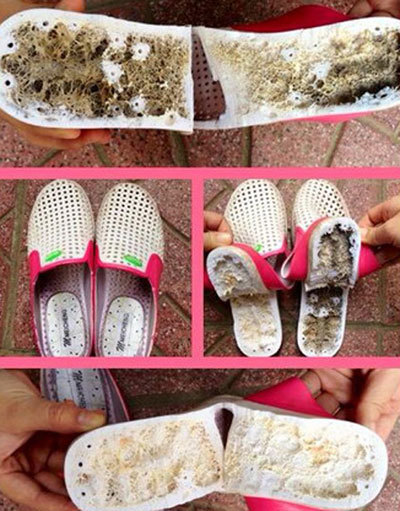 Xôn xao dép Trung Quốc gây lở loét, tê chân?