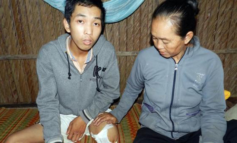 Bệnh viện cưa chân bệnh nhân do chẩn đoán sai