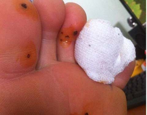 Thối chân vì lót giầy thơm Trung Quốc