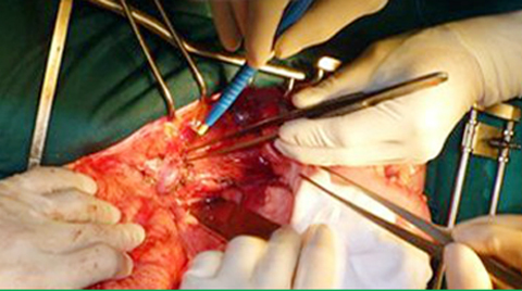 “Trở về từ cõi chết” nhờ ghép tạng