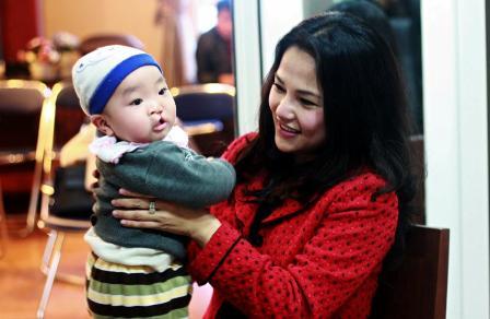 Phẫu thuật miễn phí cho 23 trẻ em nghèo bị dị tật khe hở môi
