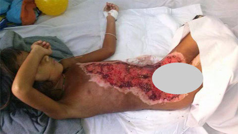 Con bỏng nặng cha không một đồng dính túi