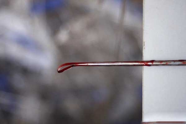 Lạnh sống lưng với những ca tự phá thai của chị em