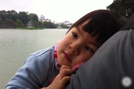 Cần 60.000 bảng Anh phẫu thuật cắt rễ dây thần kinh