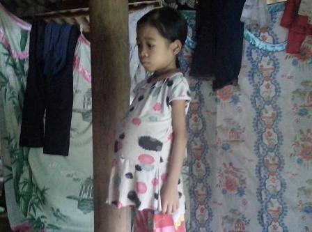 Thương hai bé người Dao mắc bệnh thiếu máu huyết tán