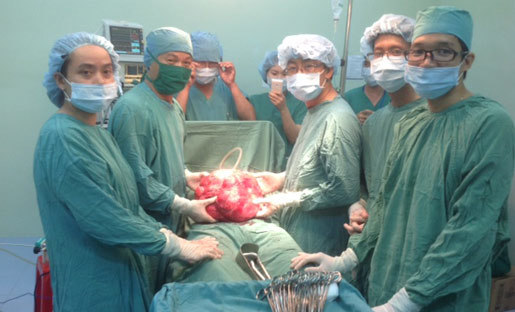 Phẫu thuật lấy khối u 11kg trong bụng bệnh nhân