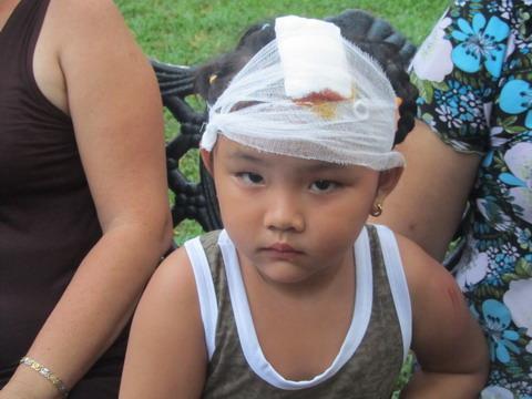 Nhánh cây rơi làm 4 người bị thương trong công viên