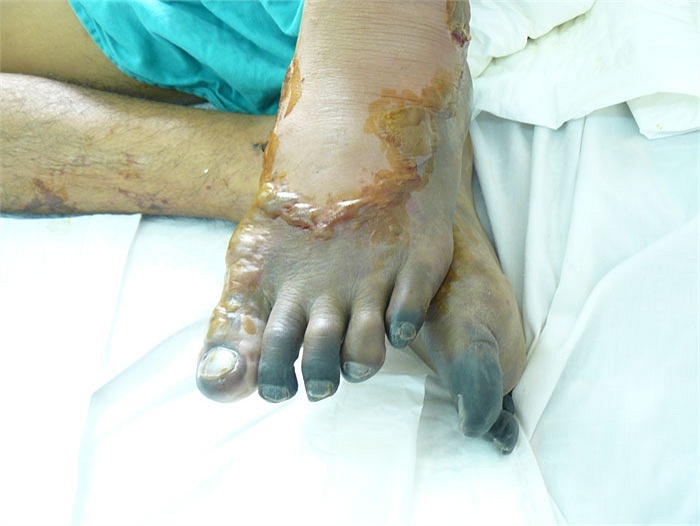 Không dám nhìn con người bị tiết canh làm biến dạng