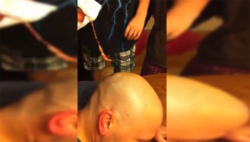 Kinh hãi móc giun ra từ đầu người