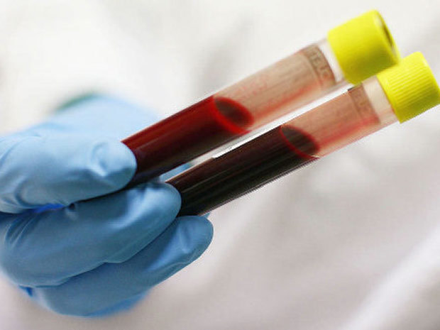 Gần 6 triệu người Việt Nam nhiễm virus viêm gan C