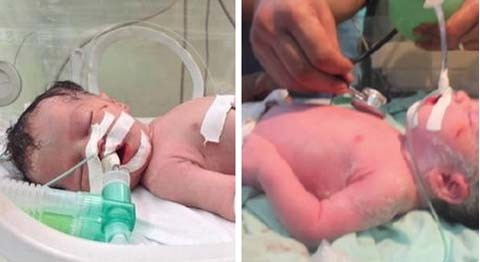 Thế giới khóc thương 'em bé kỳ diệu' ở Gaza