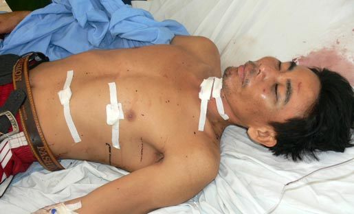 Dùng kéo giết bạn gái dã man rồi tự sát