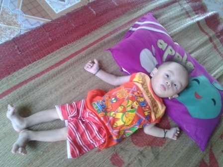 Xót xa cháu bé bị bệnh tim bẩm sinh, 14 tháng chỉ nặng 5kg