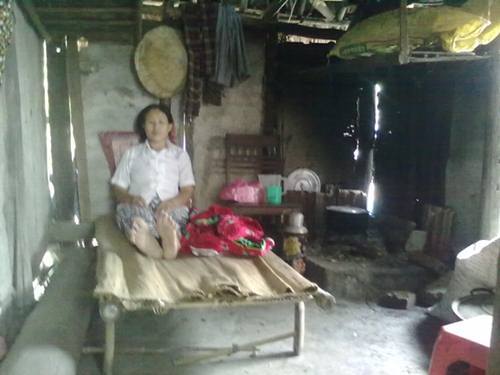 Người đàn bà mắc bệnh tim chăm anh tâm thần