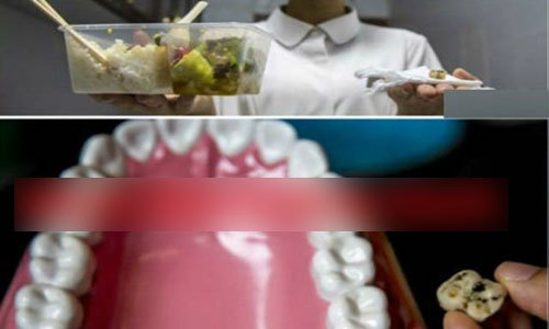 Hoảng hồn phát hiện răng lợn trong suất cơm hộp