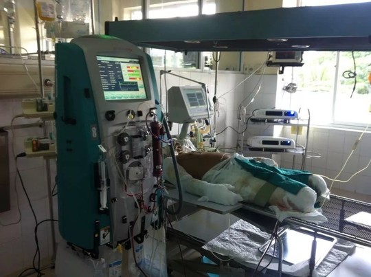 Thêm nạn nhân vụ rơi máy bay ở Hòa Lạc tử vong