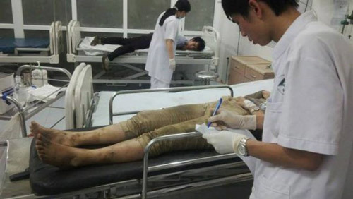 Vụ xe khách gặp nạn: Phụ xe chết não vì cây đâm thấu sọ