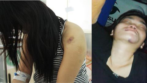 Cắn răng để chồng bạo hành vì 