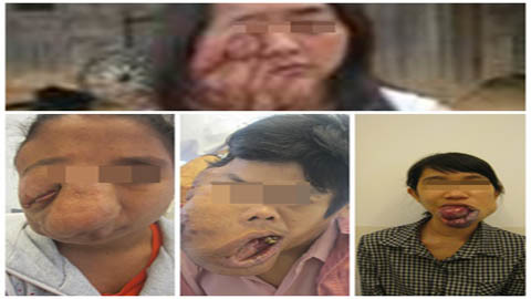 Hàng loạt bệnh nhân dị dạng mặt được... làm đẹp