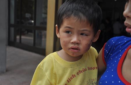 Kể lại giây phút cháu bé bị nhét băng vệ sinh vào mồm