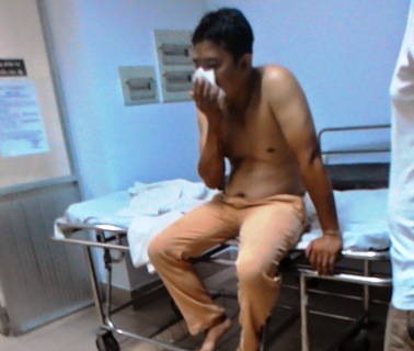 Trung uý CSGT bị ném đá vỡ mặt