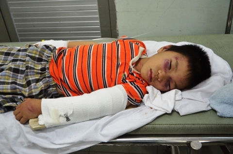 Lời khai rợn người của cha dượng đánh con riêng nứt sọ