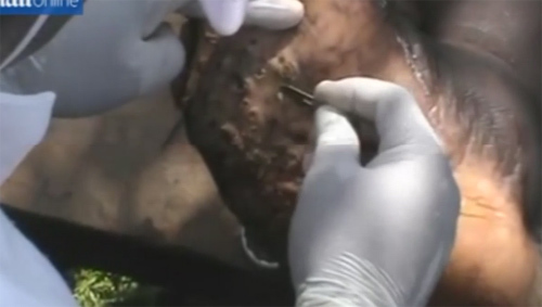 Rùng mình xem bắt bọ chét làm ổ dưới bàn chân người