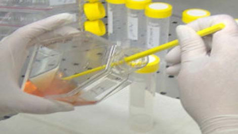 Đột phá mới trong điều trị và phòng chống HIV