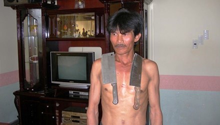 Lạ lùng người đàn ông hút chặt đồ vật sau một trận ốm