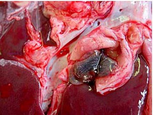 Các loại rau tiếp tay cho sán làm tổ trong cơ thể