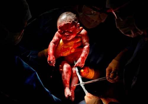 8 bức ảnh tuyệt đẹp chụp trẻ sơ sinh chỉ vài giây sau khi chào đời