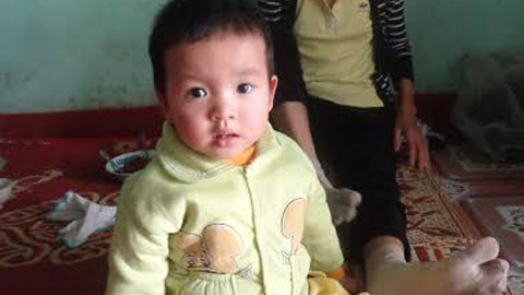 Nỗi đau người mẹ sinh 7 đứa con thì 6 đứa bị tim bẩm sinh