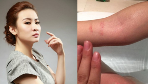 Người đẹp Hoa ngữ phát tán ảnh bị đạo diễn hãm hại, đánh đập