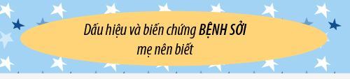 Dấu hiệu trẻ bị bệnh sởi và cách điều trị