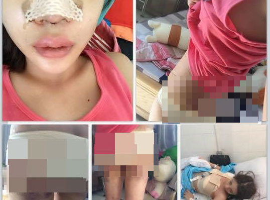 Cô gái Sài Gòn  phẫu thuật thẩm mỹ toàn thân gây sốc