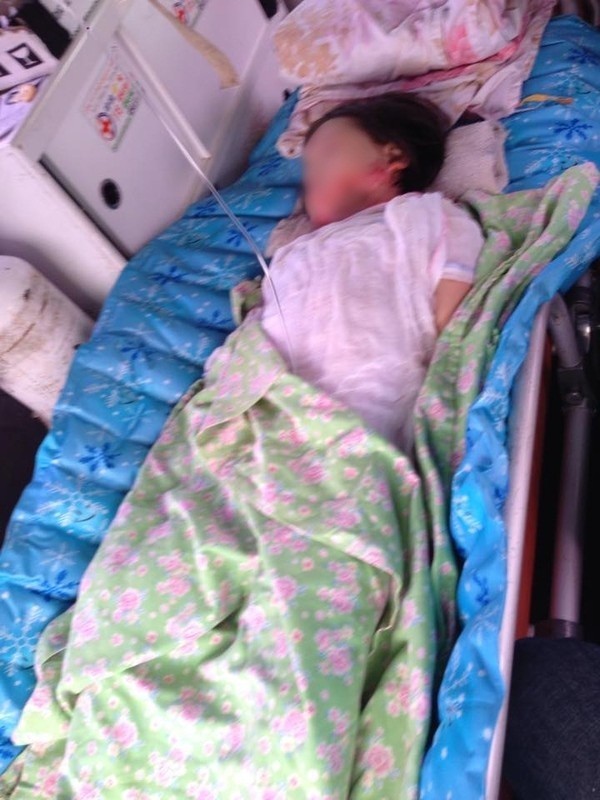 Bé gái bị bỏng nửa người đã nói được chuyện