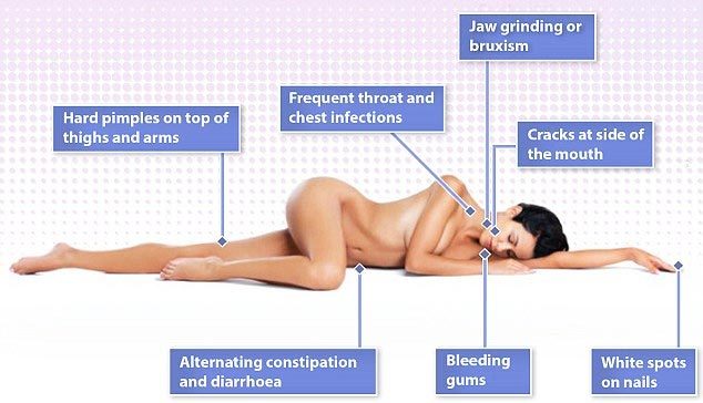 7 dấu hiệu bất ngờ tiết lộ bạn bị stress