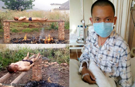 Tự 'nướng' mình để diệt tế bào ung thư