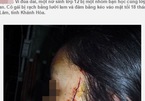 Lật tẩy chiêu trò tung tin nữ sinh bị cướp rạch mặt ở Hà Nội