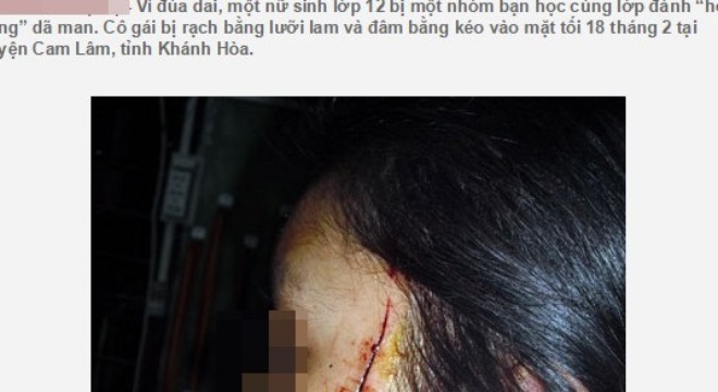 Lật tẩy chiêu trò tung tin nữ sinh bị cướp rạch mặt ở Hà Nội