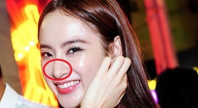Khuôn mặt chảy sệ, mũi dài biến dạng của Angela Phương Trinh