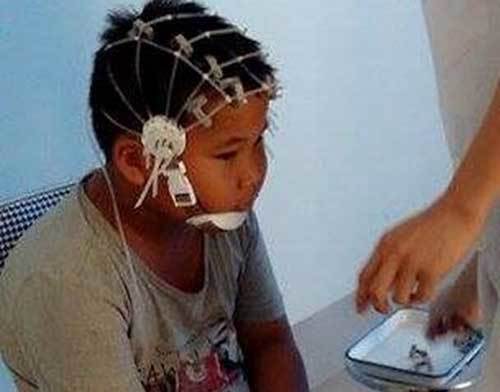 Bác sĩ hé lộ trình trạng hoảng loạn của bé trai Bắc Giang