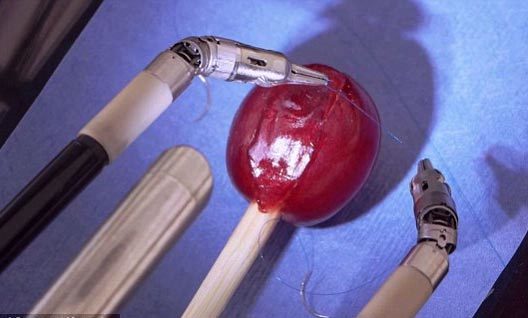 Xem robot phẫu thuật trổ tài ấn tượng
