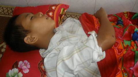 Xót thương cậu bé 13 năm chung sống với bệnh động kinh