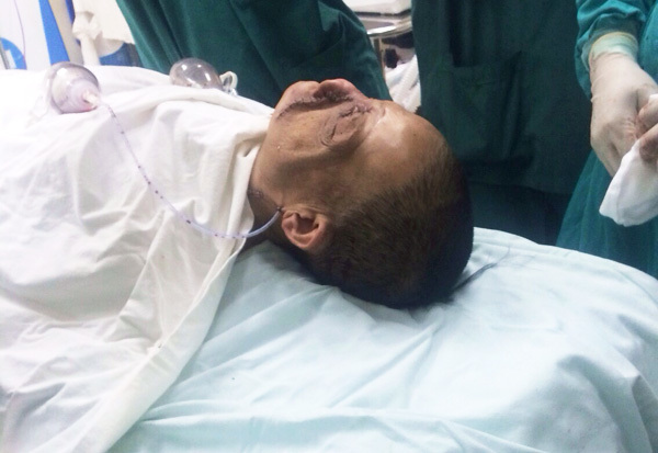 Ca phẫu thuật 6 tiếng cho bệnh nhân có khối u khổng lồ