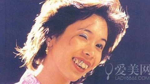 Kinh hãi trước nhan sắc xấu xí của Triệu Vy, Trương Bá Chi